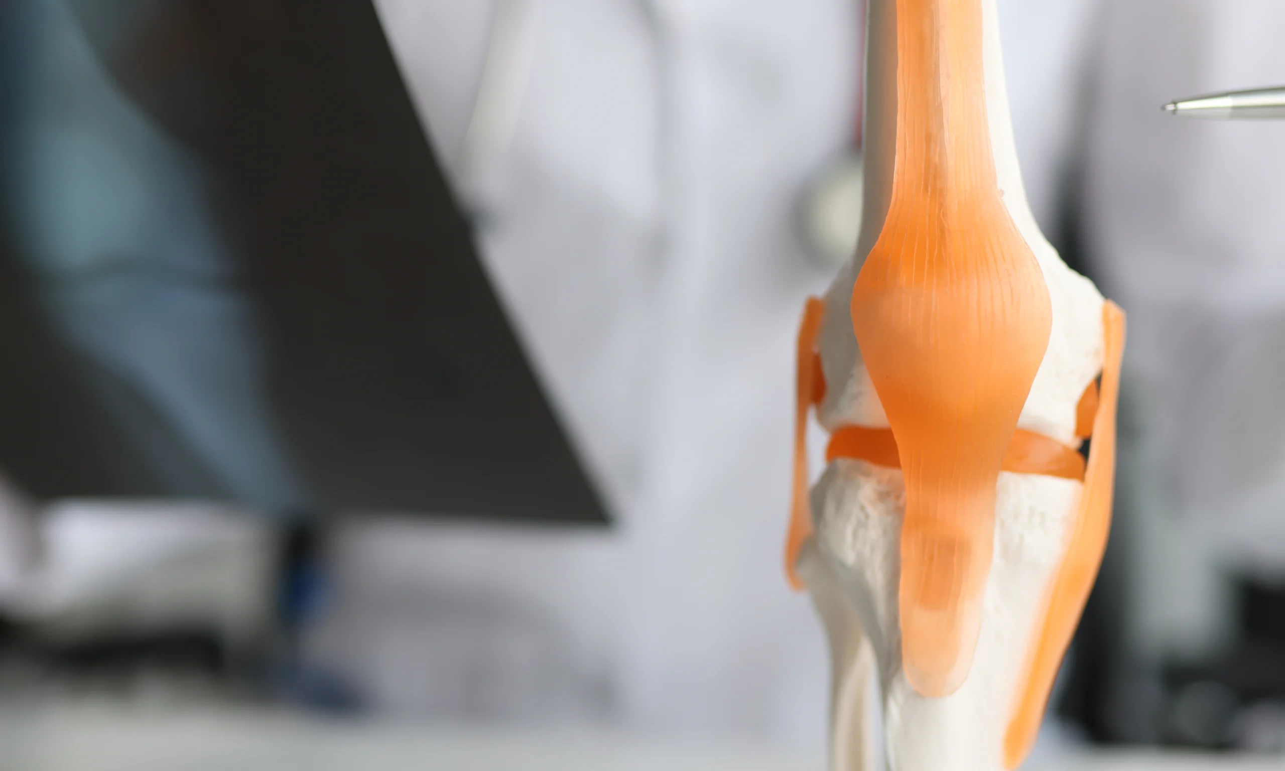 Schéma du ligament croisé antérieur du genou en gros plan